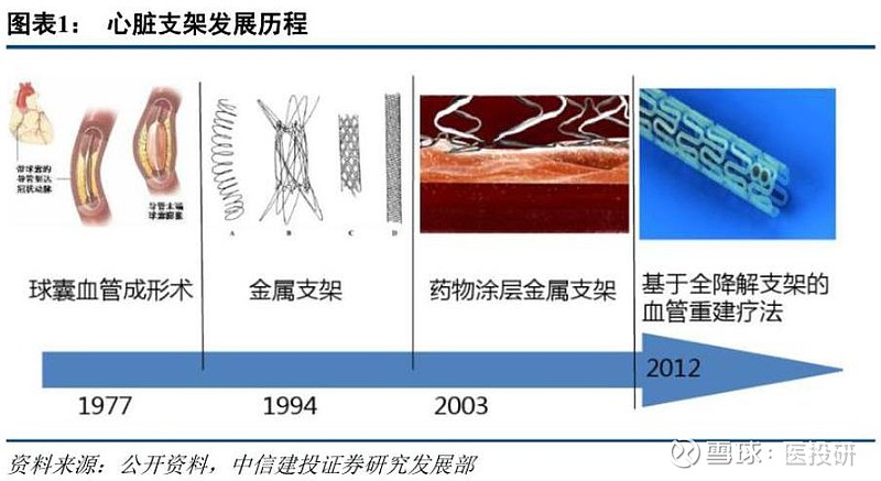 最新心血管支架价格及其相关因素探讨